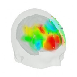 Numérisation 3D Polhemus - Artinis