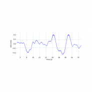Capteur Electrogastrographie (EGG) - BiosignalsPlux