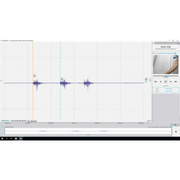 Synchronisation vidéo - Module logiciel Plux