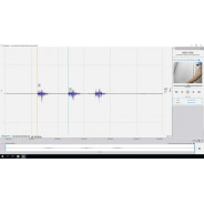 HRV - Module logiciel Plux