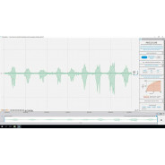 Charge musculaire - Module logiciel Plux