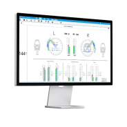 Option Mooky Fitting