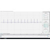 Sangle thoracique ECG CardioBAN BLE | Mtraining