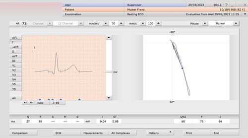 custo diagnostic — édition rapport ECG interprétation automatique