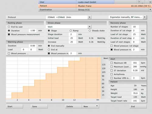 custo diagnostic — vue d'ensemble ECG 12 canaux repos